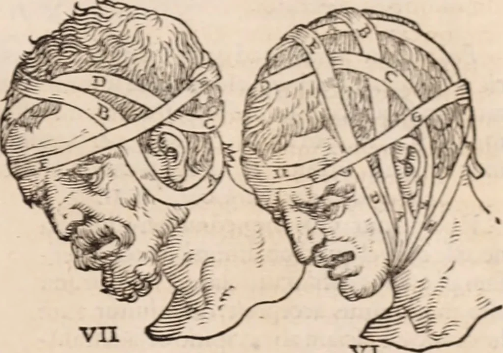 An illustration from Galeni omnia quae extant opera : in latinum sermonem conuersa, 1565, leaf 1198