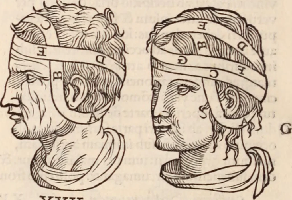 An illustration from Galeni omnia quae extant opera : in latinum sermonem conuersa, 1565, leaf 1201