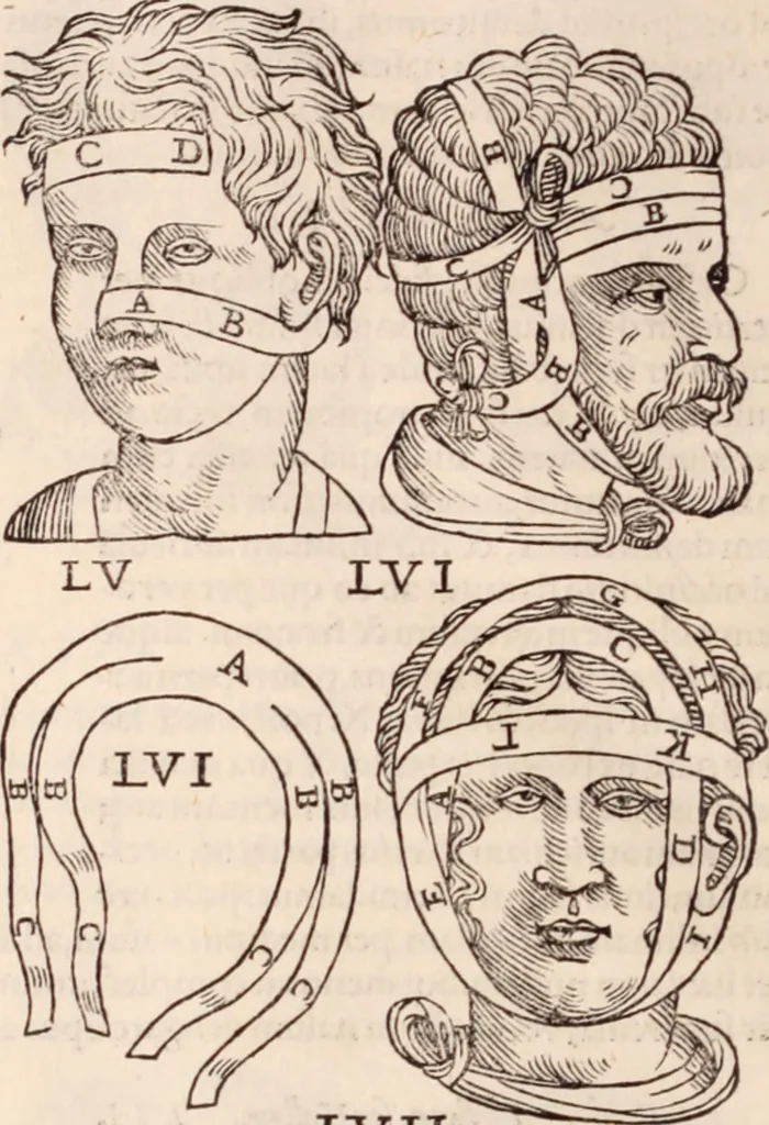 An illustration from Galeni omnia quae extant opera : in latinum sermonem conuersa, 1565, leaf 1207
