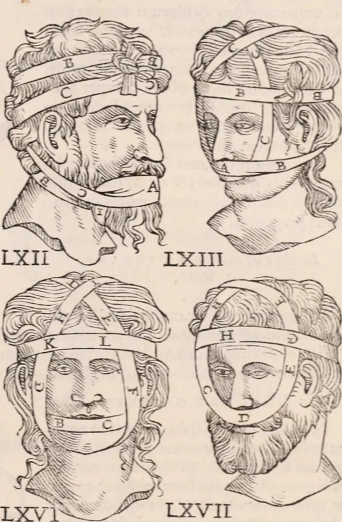 An illustration from Galeni omnia quae extant opera : in latinum sermonem conuersa, 1565, leaf 1208