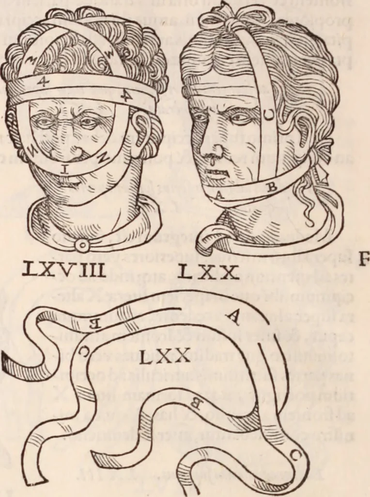 An illustration from Galeni omnia quae extant opera : in latinum sermonem conuersa, 1565, leaf 1209