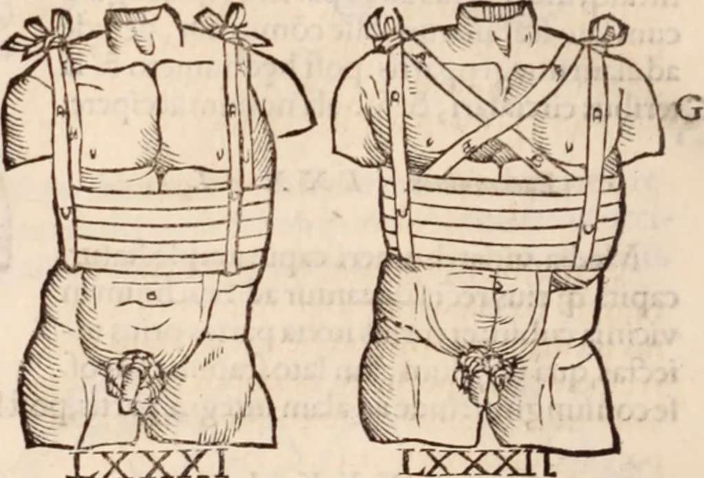An illustration from Galeni omnia quae extant opera : in latinum sermonem conuersa, 1565, leaf 1211