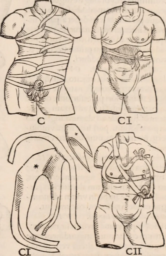 An illustration from Galeni omnia quae extant opera : in latinum sermonem conuersa, 1565, leaf 1214