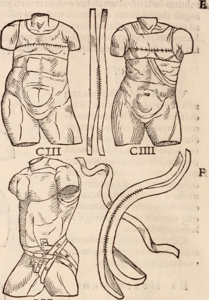 An illustration from Galeni omnia quae extant opera : in latinum sermonem conuersa, 1565, leaf 1215