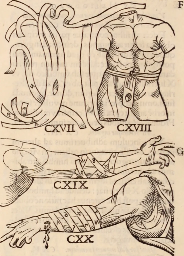 An illustration from Galeni omnia quae extant opera : in latinum sermonem conuersa, 1565, leaf 1217