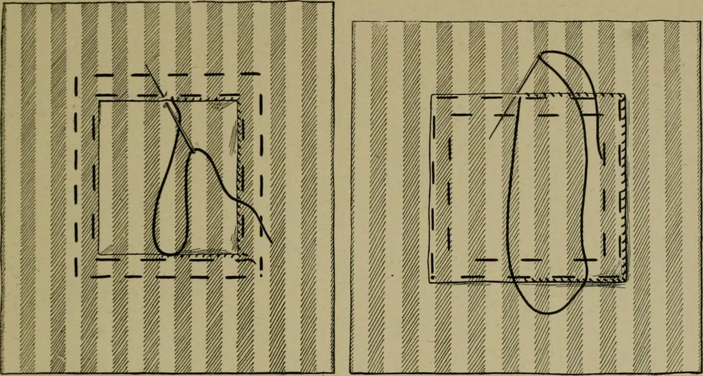 An illustration from Goodwin's course in sewing; practical instruction in needlework for use in schools and at home, 1910, leaf 33