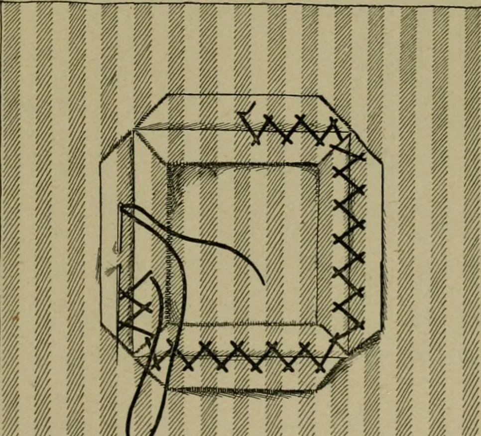 An illustration from Goodwin's course in sewing; practical instruction in needlework for use in schools and at home, 1910, leaf 35