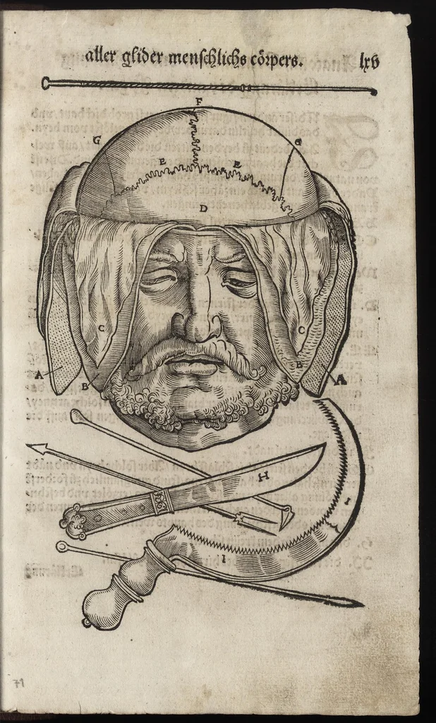 An illustration from Des aller fürtrefflichsten, höchsten vnnd adelichsten Gschöpffs aller Creaturen von Got dem Herren, Schöpffer aller Ding auff Erden, erschaffen : das ist, des Menschen (oder dein selbst) warhafftige Beschreibung, oder, Anatomi seines wunderbarlichen Vrsprungs ..., 1541, leaf 148