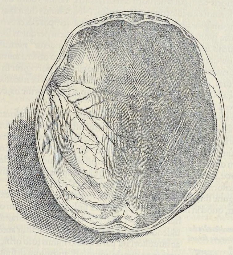 An illustration from Andreae Vesalii Bruxellensis, scholae medicorum Patauinae professoris De humani corporis fabrica libri septem, 1543, leaf 70