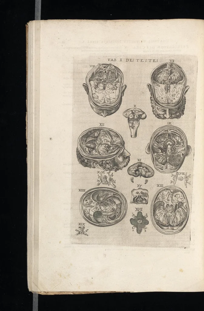 An illustration from Tables anatomiqves, avec les povrtraicts et declaration d'iceulx : ensemble vn denombrement de cinq cens maladies diuerses ..., 1586, leaf 79