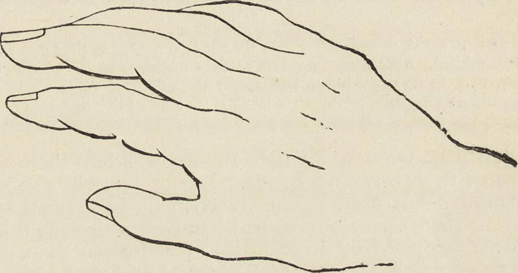 An illustration from Beeton's housewife's treasury of domestic information : comprising complete and practical instructions on the house and its furniture, artistic decoration economy, toilet, children, etiquette, domestic and fancy needlework, dressmaking and millinery, and all other household matters : with every requisite direction to secure the comfort, elegance, and prosperity of the home : a companion volume to "Mrs. Beeton's book of household management" : profusely illustrated, 1879, leaf 654