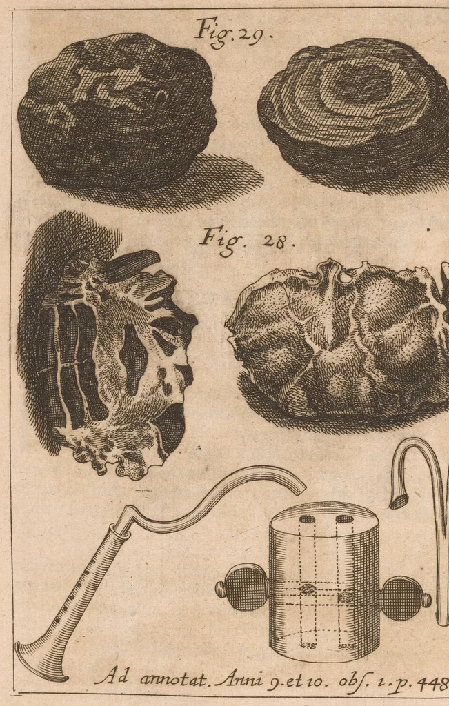 An illustration from Miscellanea curiosa, sive, Ephemeridum medico-physicarum Germanicarum, 1677, leaf 475