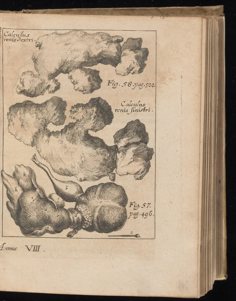 An illustration from Miscellanea curiosa, sive, Ephemeridum medico-physicarum Germanicarum, 1677, leaf 574