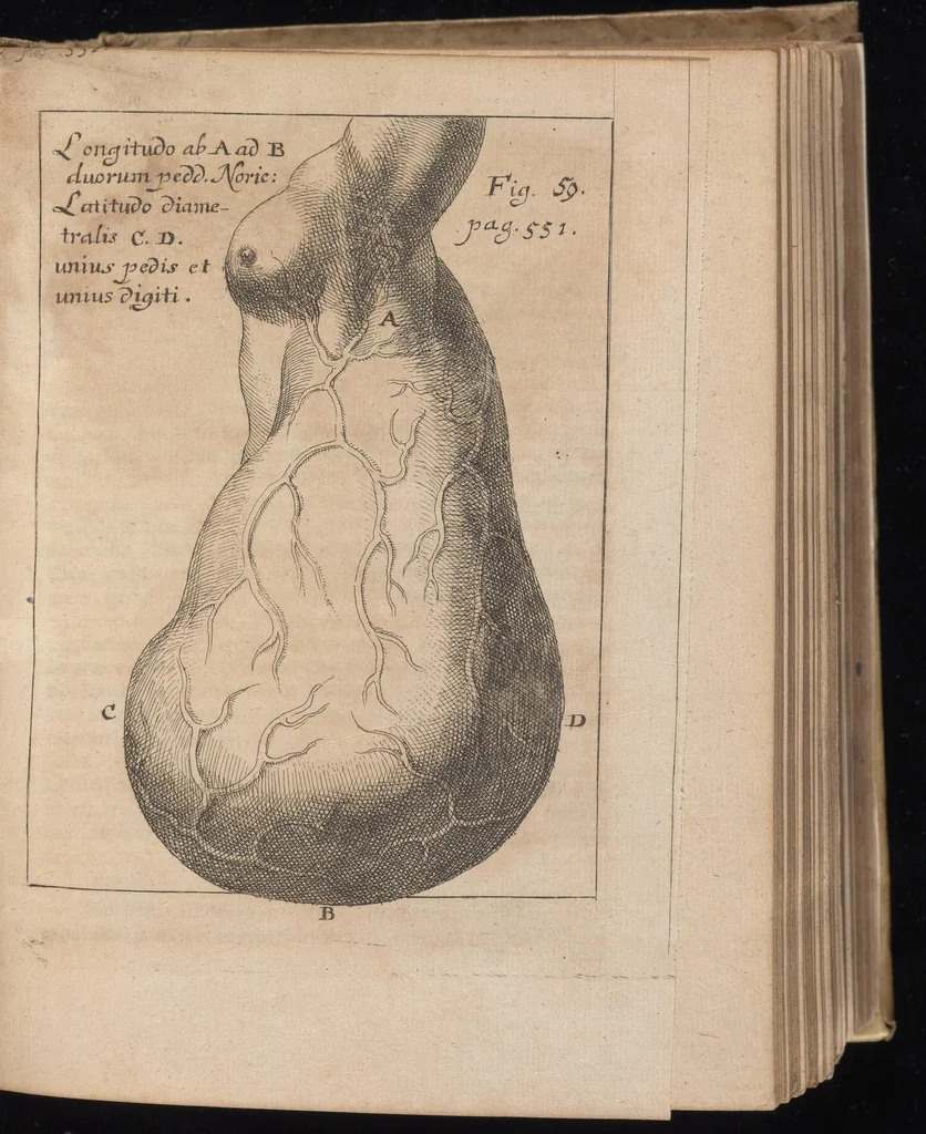 An illustration from Miscellanea curiosa, sive, Ephemeridum medico-physicarum Germanicarum, 1677, leaf 632