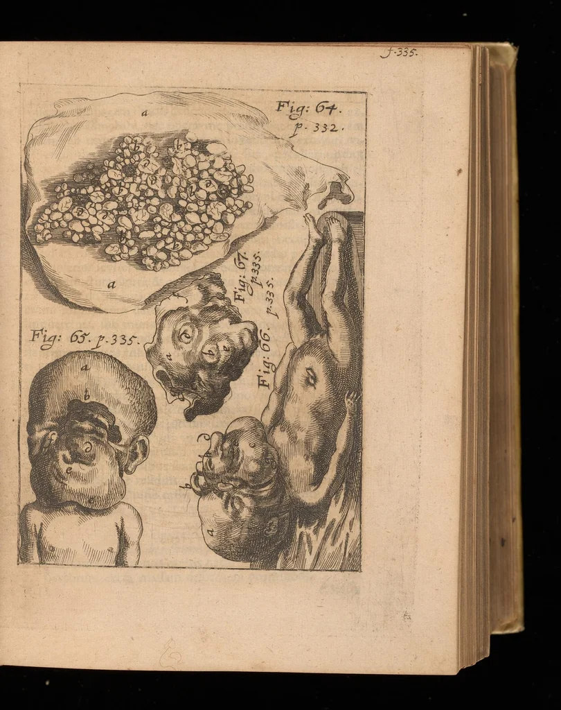 An illustration from Miscellanea curiosa, sive, Ephemeridum medico-physicarum Germanicarum, 1677, leaf 422
