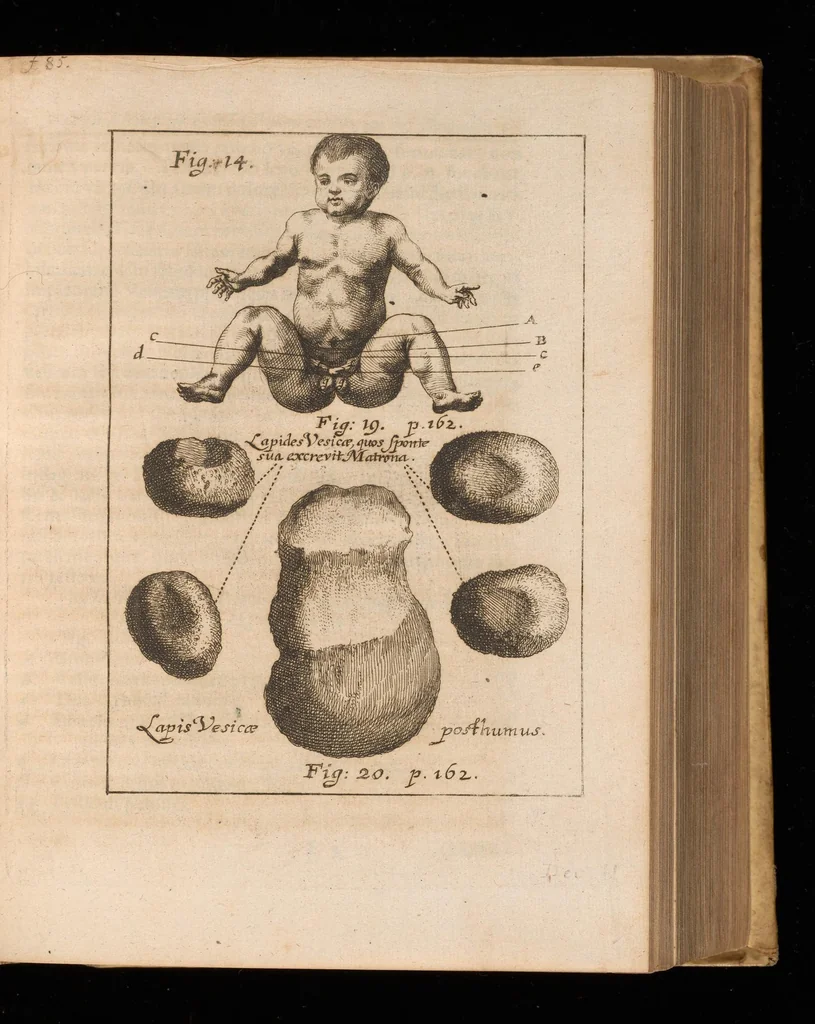 An illustration from Miscellanea curiosa, sive, Ephemeridum medico-physicarum Germanicarum, 1677, leaf 812