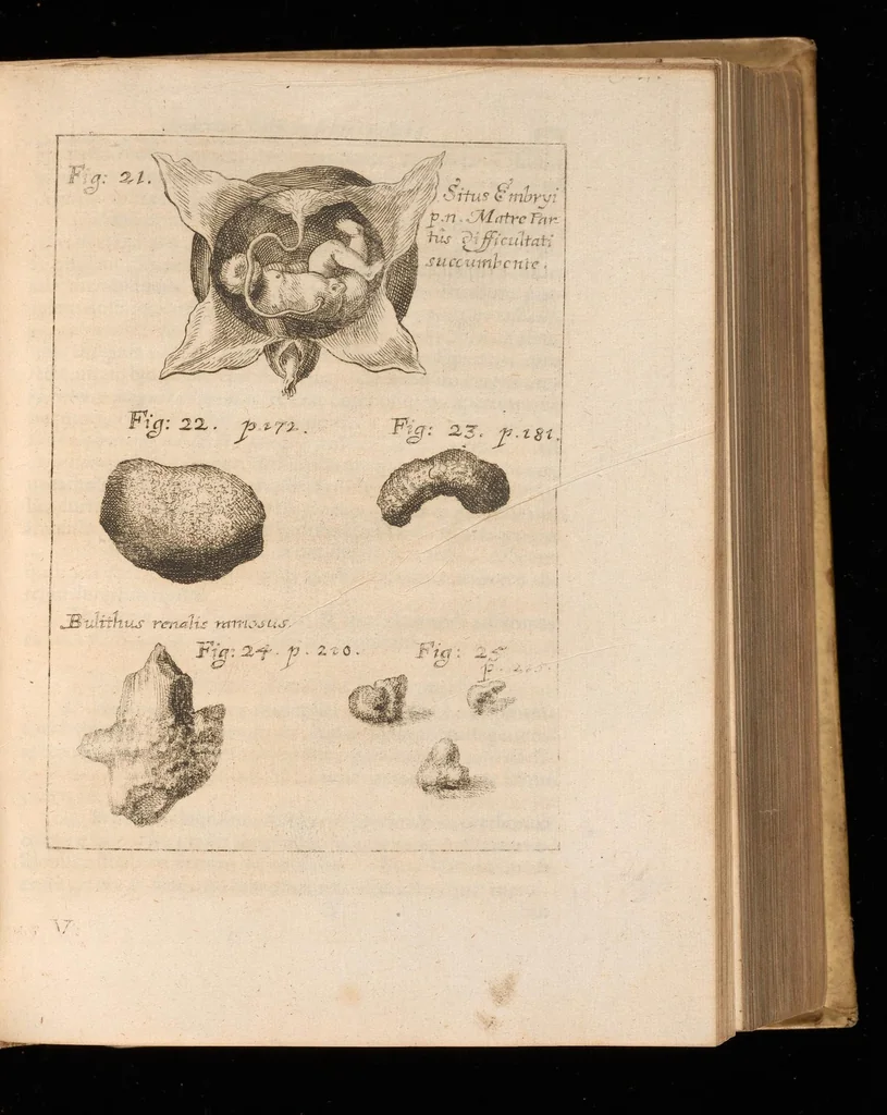 An illustration from Miscellanea curiosa, sive, Ephemeridum medico-physicarum Germanicarum, 1677, leaf 906