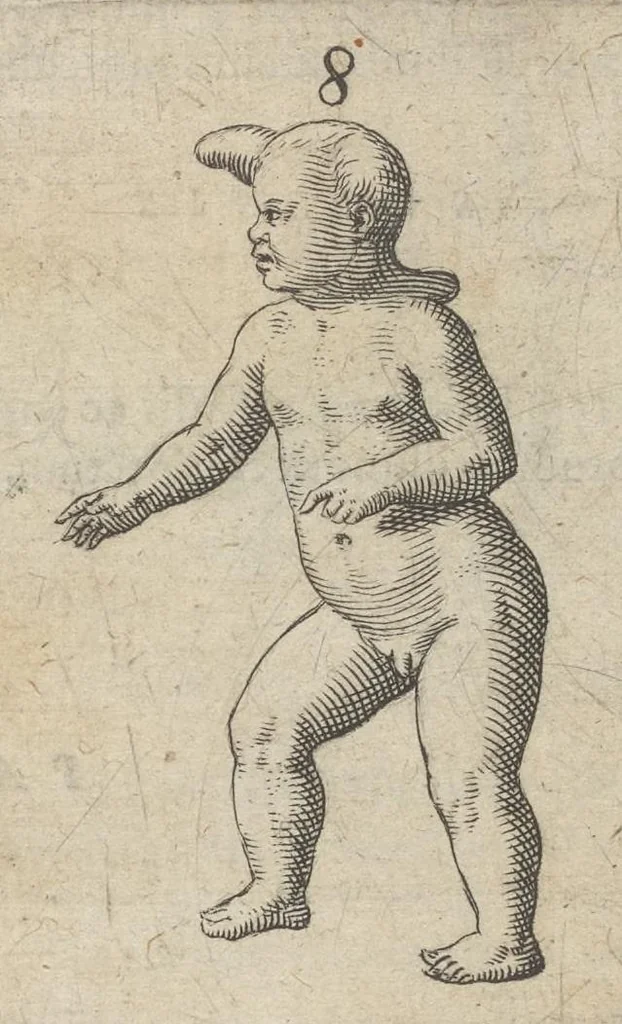 An illustration from Monstrorum historia memorabilis : monstrosa humanorum partuum miracula : stupendis conformationum formulis ab vtero materno enata : viuis exemplis, obseruationibus, & picturis, referens : accessit analogicum argumentum de monstris brutis : Supplementi loco ad observationes medicas Schenkianas edita, 1609, leaf 20