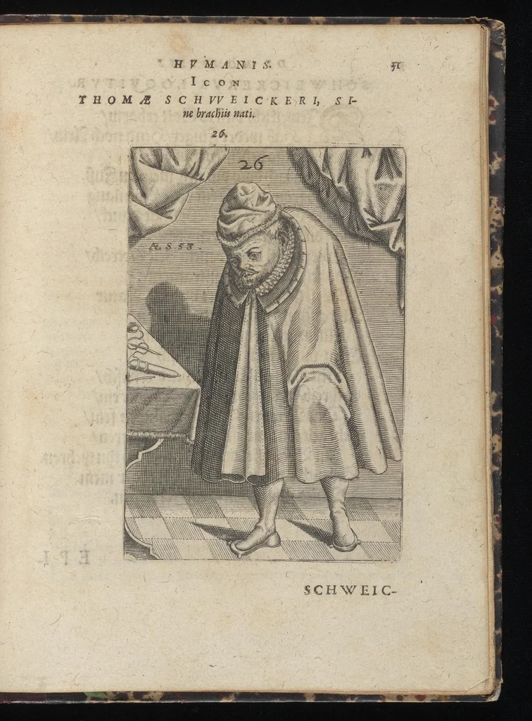 An illustration from Monstrorum historia memorabilis : monstrosa humanorum partuum miracula : stupendis conformationum formulis ab vtero materno enata : viuis exemplis, obseruationibus, & picturis, referens : accessit analogicum argumentum de monstris brutis : Supplementi loco ad observationes medicas Schenkianas edita, 1609, leaf 42
