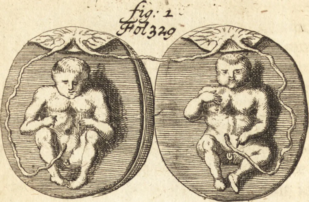 An illustration from C. Stalpartii vander Wiel medici Hagiensis Observationum rariorum medic. anatomic. chirurgicarum centuria prior : accedit De unicornu dissertatio : utraque tertia parte auctior, longeque emendatior, 1687, leaf 358