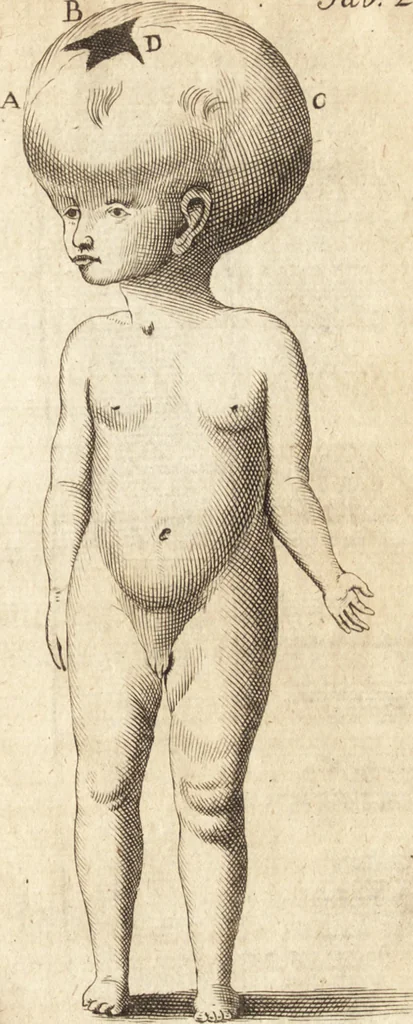 An illustration from C. Stalpartii vander Wiel medici Hagiensis Observationum rariorum medic. anatomic. chirurgicarum centuria prior : accedit De unicornu dissertatio : utraque tertia parte auctior, longeque emendatior, 1687, leaf 142