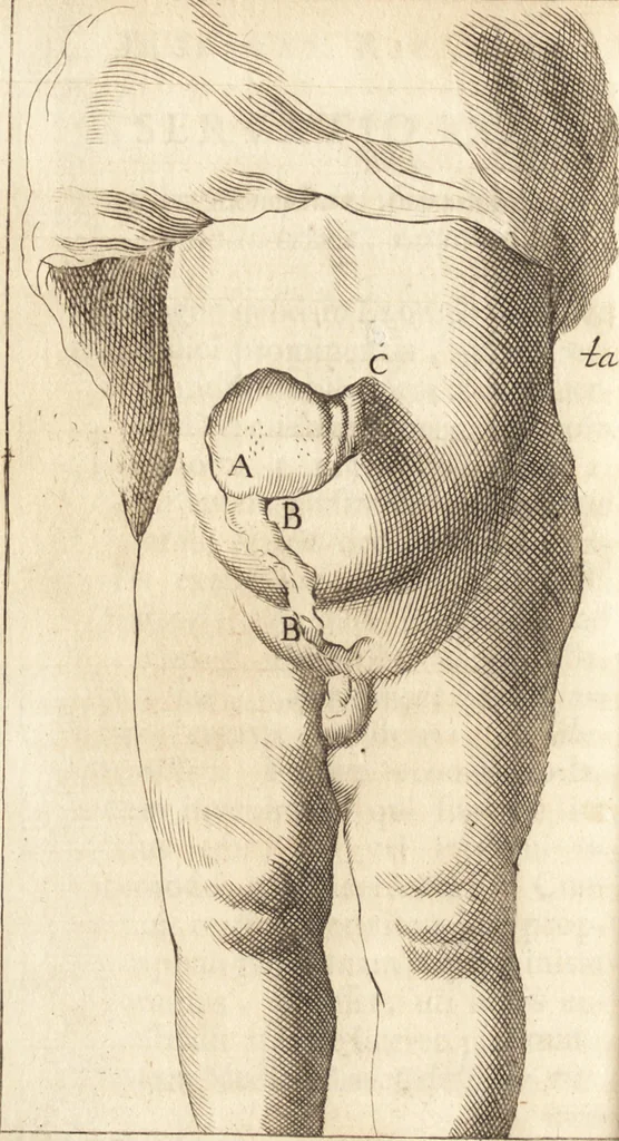 An illustration from C. Stalpartii vander Wiel medici Hagiensis Observationum rariorum medic. anatomic. chirurgicarum centuria prior : accedit De unicornu dissertatio : utraque tertia parte auctior, longeque emendatior, 1687, leaf 407