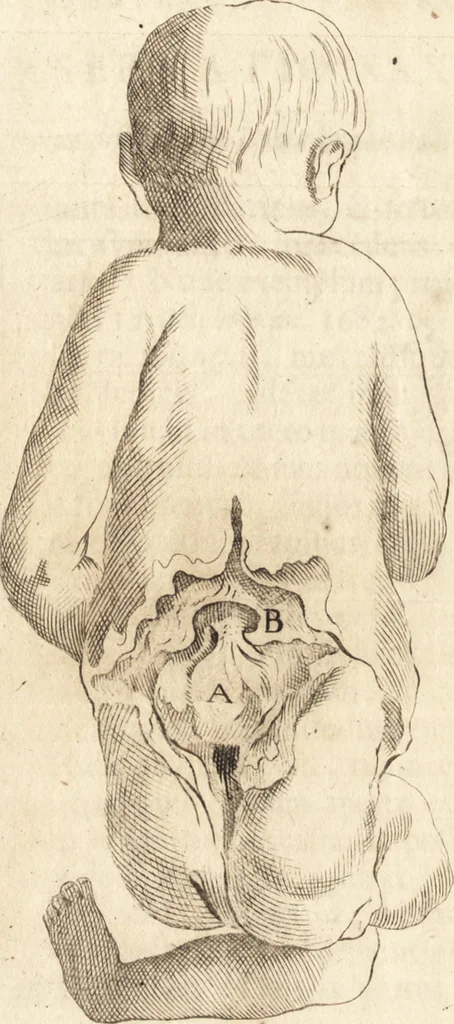 An illustration from C. Stalpartii vander Wiel medici Hagiensis Observationum rariorum medic. anatomic. chirurgicarum centuria prior : accedit De unicornu dissertatio : utraque tertia parte auctior, longeque emendatior, 1687, leaf 413