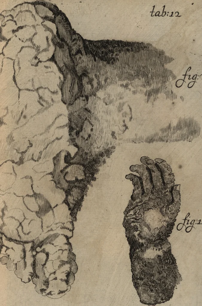 An illustration from C. Stalpartii vander Wiel medici Hagiensis Observationum rariorum medic. anatomic. chirurgicarum centuria prior : accedit De unicornu dissertatio : utraque tertia parte auctior, longeque emendatior, 1687, leaf 426
