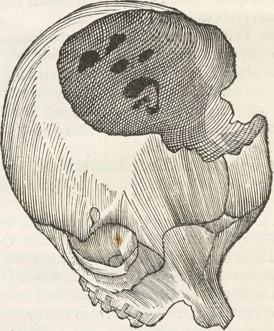 An illustration from Museum Wormianum, seu, Historia rerum rariorum : tam naturalium, quam artificialium, tam domesticarum, quam exoticarum, quae Hafniae Danorum in aedibus authoris servantur, 1655, leaf 371