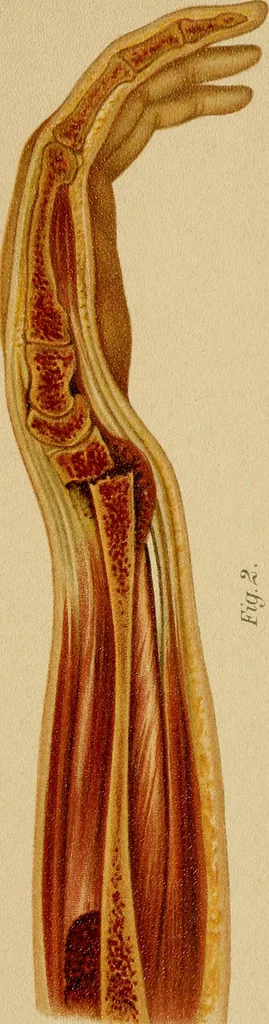 An illustration from Grundriss und Atlas der allgemeinen Chirurgie, 1905, leaf 119