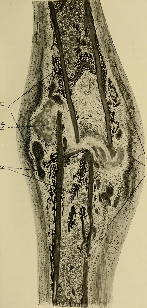 An illustration from Grundriss und Atlas der allgemeinen Chirurgie, 1905, leaf 123