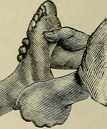 An illustration from Grundriss und Atlas der allgemeinen Chirurgie, 1905, leaf 128