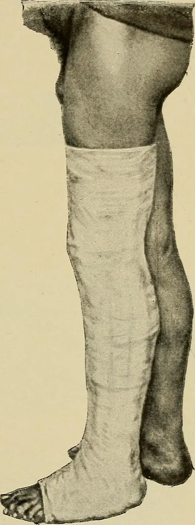 An illustration from Grundriss und Atlas der allgemeinen Chirurgie, 1905, leaf 129