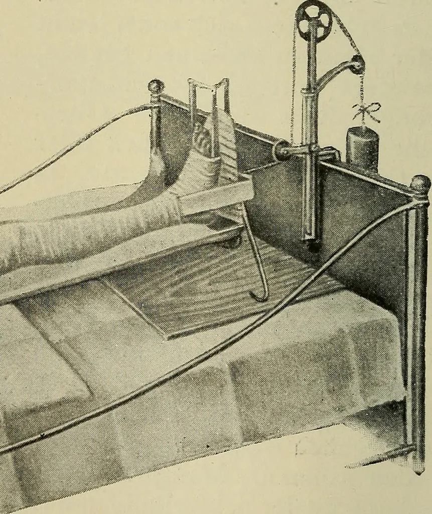 An illustration from Grundriss und Atlas der allgemeinen Chirurgie, 1905, leaf 130