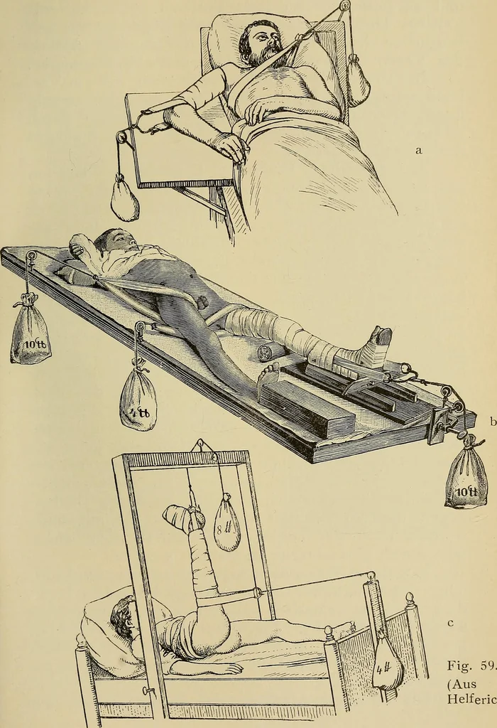An illustration from Grundriss und Atlas der allgemeinen Chirurgie, 1905, leaf 131