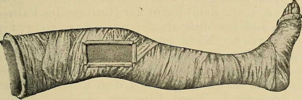 An illustration from Grundriss und Atlas der allgemeinen Chirurgie, 1905, leaf 141