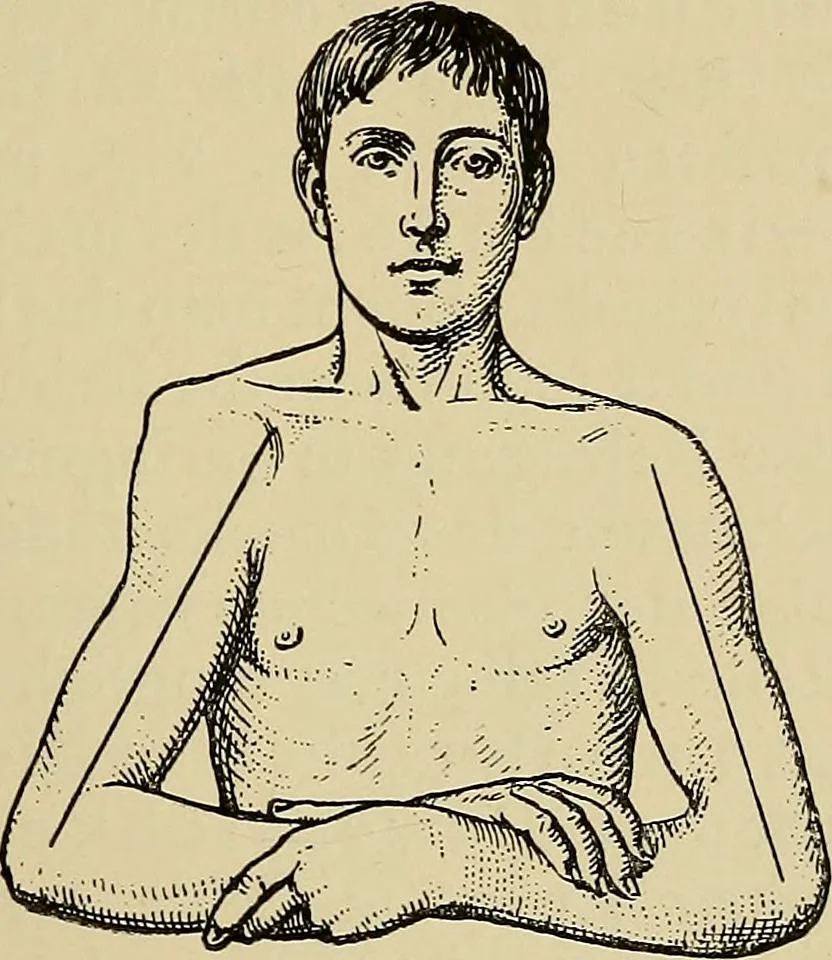 An illustration from Grundriss und Atlas der allgemeinen Chirurgie, 1905, leaf 149