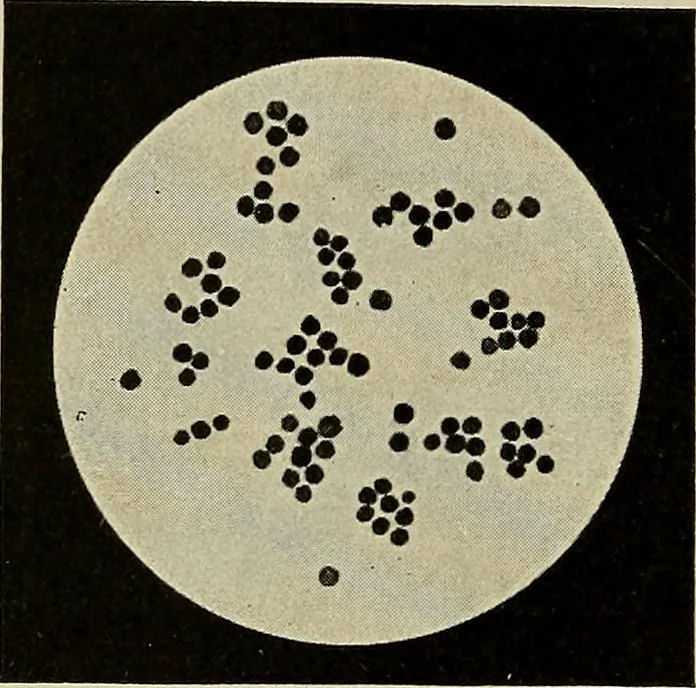 An illustration from Grundriss und Atlas der allgemeinen Chirurgie, 1905, leaf 212