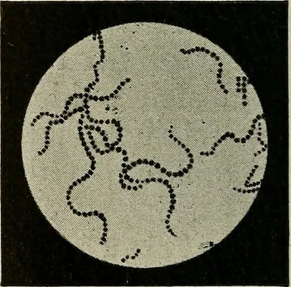 An illustration from Grundriss und Atlas der allgemeinen Chirurgie, 1905, leaf 212