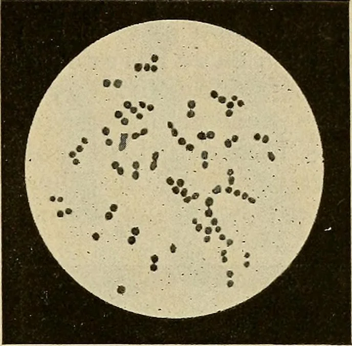 An illustration from Grundriss und Atlas der allgemeinen Chirurgie, 1905, leaf 213