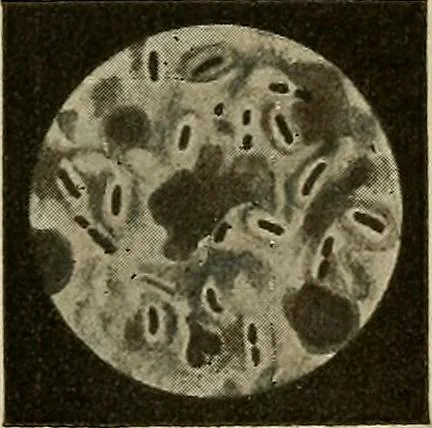 An illustration from Grundriss und Atlas der allgemeinen Chirurgie, 1905, leaf 213