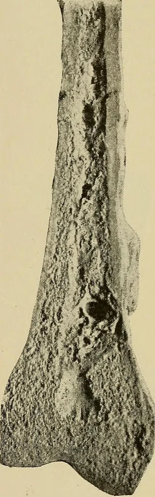 An illustration from Grundriss und Atlas der allgemeinen Chirurgie, 1905, leaf 269