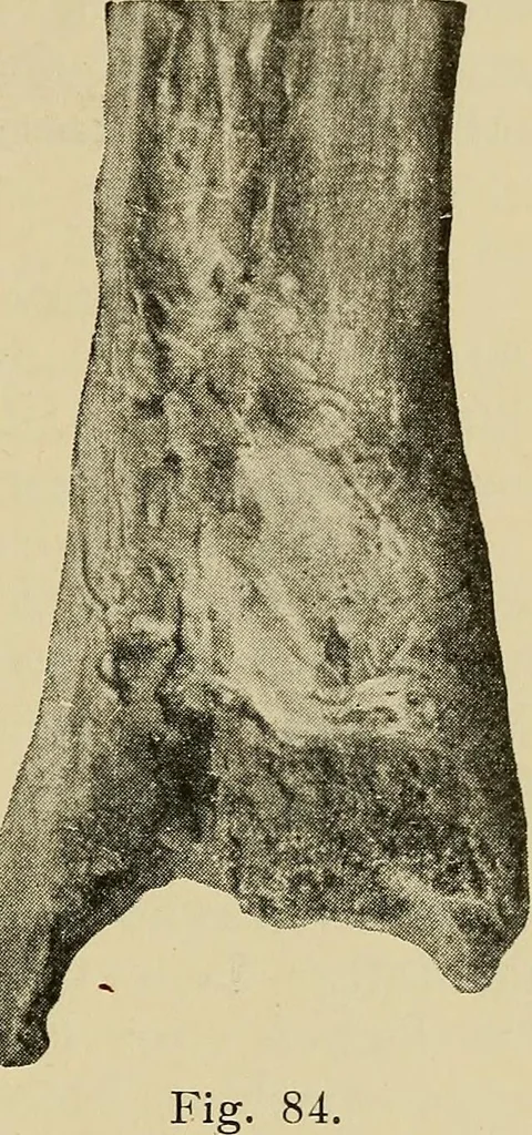 An illustration from Grundriss und Atlas der allgemeinen Chirurgie, 1905, leaf 275