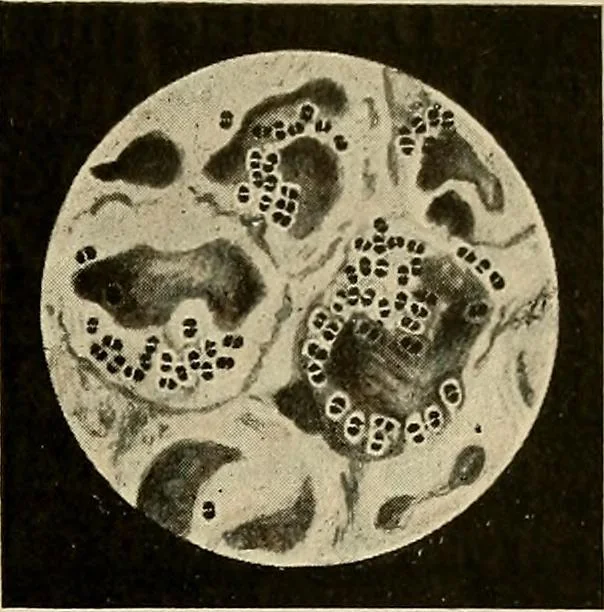 An illustration from Grundriss und Atlas der allgemeinen Chirurgie, 1905, leaf 301