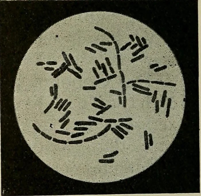 An illustration from Grundriss und Atlas der allgemeinen Chirurgie, 1905, leaf 302
