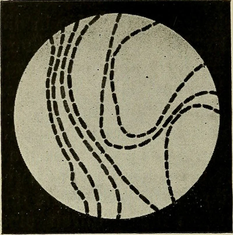 An illustration from Grundriss und Atlas der allgemeinen Chirurgie, 1905, leaf 304