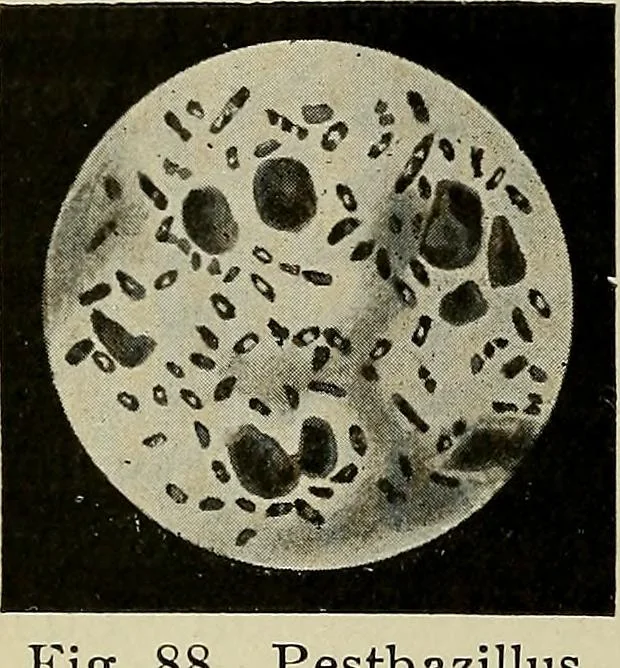 An illustration from Grundriss und Atlas der allgemeinen Chirurgie, 1905, leaf 308