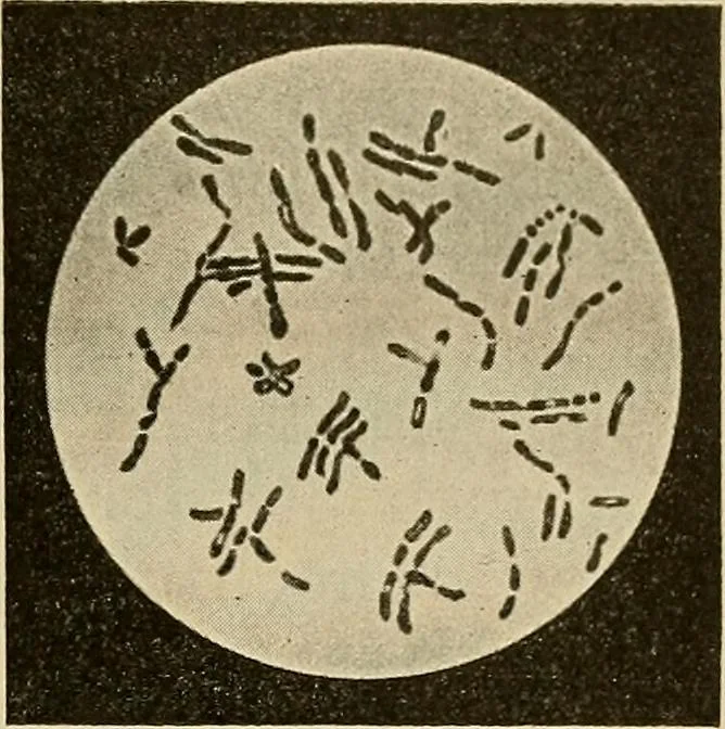 An illustration from Grundriss und Atlas der allgemeinen Chirurgie, 1905, leaf 317