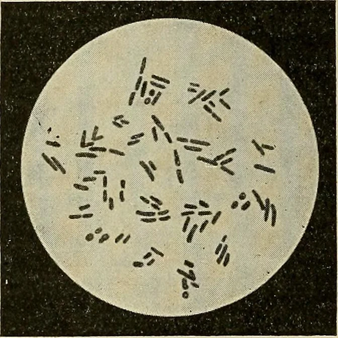 An illustration from Grundriss und Atlas der allgemeinen Chirurgie, 1905, leaf 326