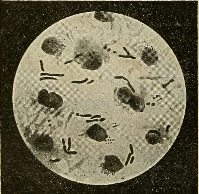 An illustration from Grundriss und Atlas der allgemeinen Chirurgie, 1905, leaf 328